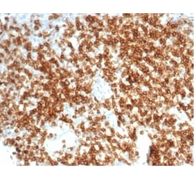 Immunohistochemistry - Anti-CD6 Antibody [C6/7022R] - BSA and Azide free (A278682) - Antibodies.com