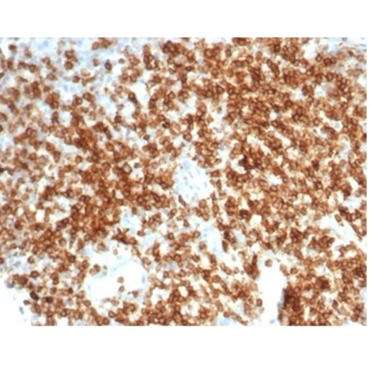 Immunohistochemistry - Anti-CD6 Antibody [C6/7022R] - BSA and Azide free (A278682) - Antibodies.com