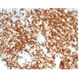 Immunohistochemistry - Anti-CD6 Antibody [C6/7022R] - BSA and Azide free (A278682) - Antibodies.com