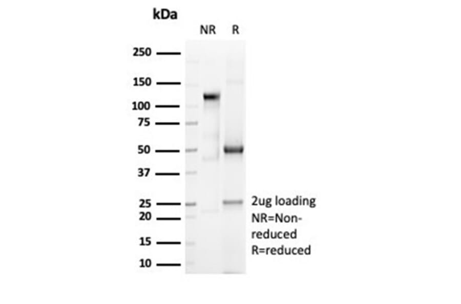 SDS-PAGE - Anti-CD6 Antibody [C6/7022R] - BSA and Azide free (A278682) - Antibodies.com