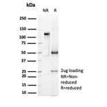 SDS-PAGE - Anti-CD6 Antibody [C6/7022R] - BSA and Azide free (A278682) - Antibodies.com