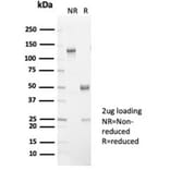 SDS-PAGE - Anti-L-PLUNC Antibody [LPLUNC1/7059R] - BSA and Azide free (A278683) - Antibodies.com