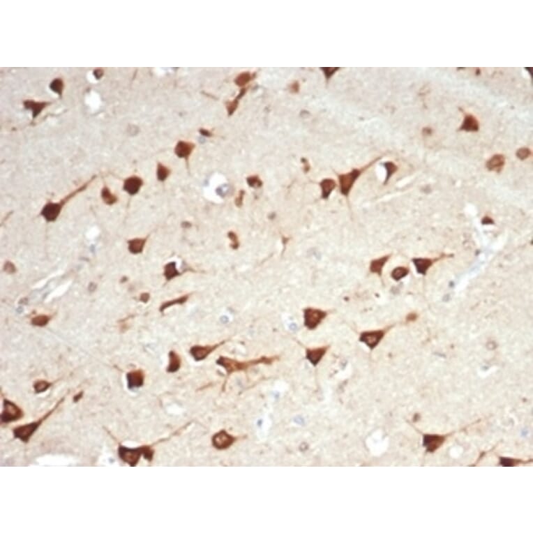 Immunohistochemistry - Anti-L-PLUNC Antibody [LPLUNC1/7059R] - BSA and Azide free (A278683) - Antibodies.com