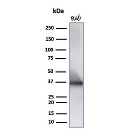 Western Blot - Anti-CD20 Antibody [IGEL/6850R] - BSA and Azide free (A278684) - Antibodies.com