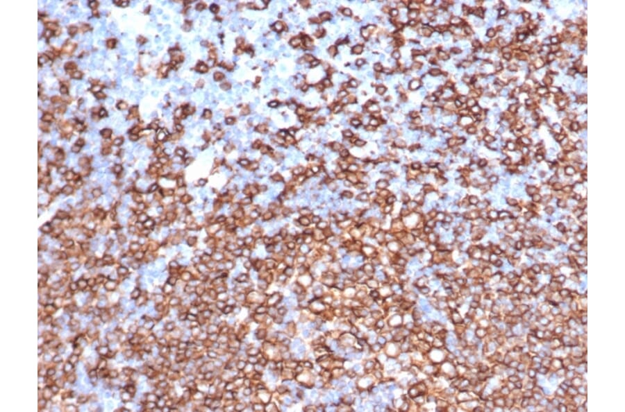 Immunohistochemistry - Anti-CD20 Antibody [IGEL/6850R] - BSA and Azide free (A278684) - Antibodies.com