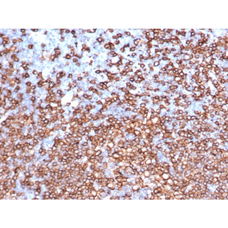 Immunohistochemistry - Anti-CD20 Antibody [IGEL/6850R] - BSA and Azide free (A278684) - Antibodies.com