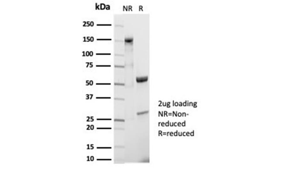 SDS-PAGE - Anti-CD20 Antibody [IGEL/7015R] - BSA and Azide free (A278685) - Antibodies.com