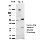 SDS-PAGE - Anti-CD20 Antibody [IGEL/7015R] - BSA and Azide free (A278685) - Antibodies.com