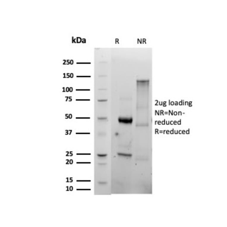 SDS-PAGE - Anti-CD86 Antibody [C86/6500R] - BSA and Azide free (A278686) - Antibodies.com