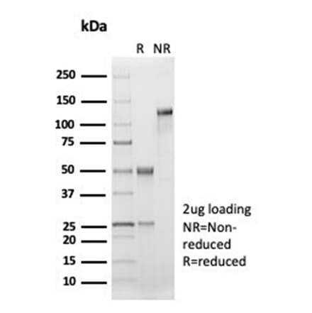 SDS-PAGE - Anti-CD33 Antibody [SIGLEC3/7046R] - BSA and Azide free (A278687) - Antibodies.com