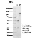 SDS-PAGE - Anti-CD33 Antibody [SIGLEC3/7046R] - BSA and Azide free (A278687) - Antibodies.com