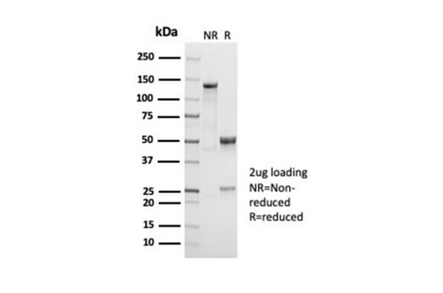 SDS-PAGE - Anti-CD38 Antibody [CD38/7017R] - BSA and Azide free (A278688) - Antibodies.com