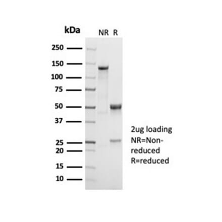 SDS-PAGE - Anti-CD38 Antibody [CD38/7017R] - BSA and Azide free (A278688) - Antibodies.com