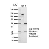 SDS-PAGE - Anti-CD38 Antibody [CD38/7017R] - BSA and Azide free (A278688) - Antibodies.com