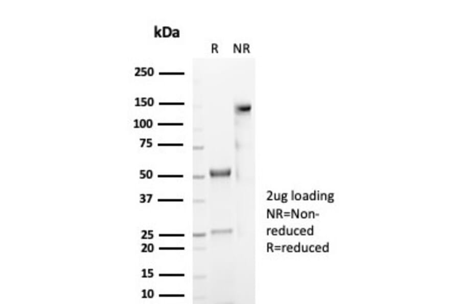 SDS-PAGE - Anti-CD59 Antibody [MACIF/7021R] - BSA and Azide free (A278689) - Antibodies.com