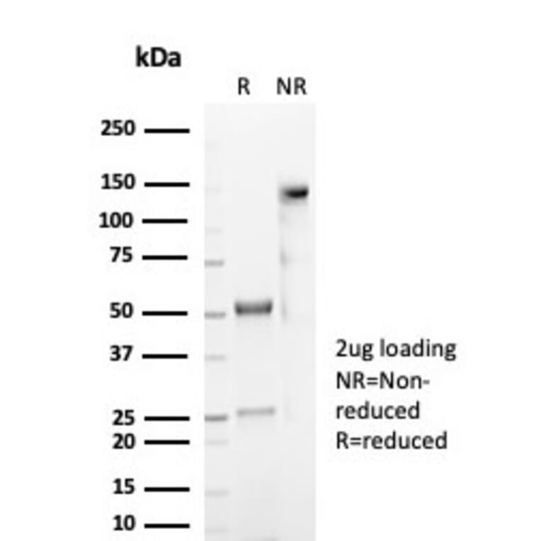 SDS-PAGE - Anti-CD59 Antibody [MACIF/7021R] - BSA and Azide free (A278689) - Antibodies.com