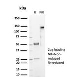 SDS-PAGE - Anti-CD59 Antibody [MACIF/7021R] - BSA and Azide free (A278689) - Antibodies.com