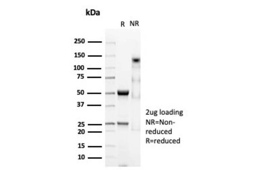 SDS-PAGE - Anti-CD74 Antibody [CLIP/7023R] - BSA and Azide free (A278690) - Antibodies.com