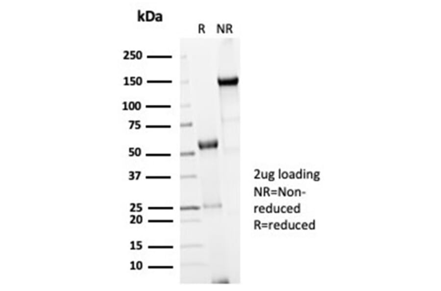 SDS-PAGE - Anti-CDC20 Antibody [CDC20/7026R] - BSA and Azide free (A278691) - Antibodies.com