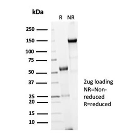SDS-PAGE - Anti-CDC20 Antibody [CDC20/7026R] - BSA and Azide free (A278691) - Antibodies.com