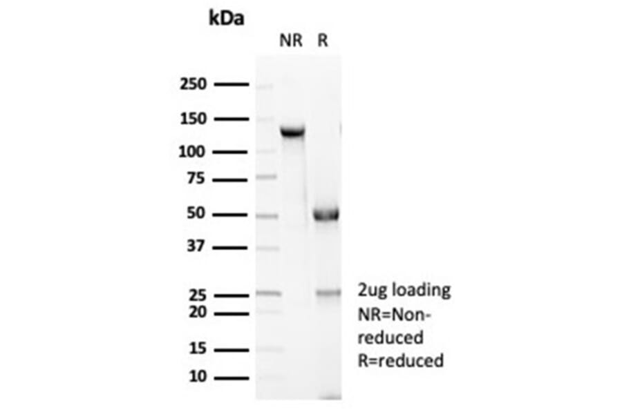 SDS-PAGE - Anti-E Cadherin Antibody [CDH1/7034R] - BSA and Azide free (A278692) - Antibodies.com