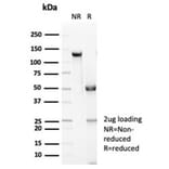 SDS-PAGE - Anti-E Cadherin Antibody [CDH1/7034R] - BSA and Azide free (A278692) - Antibodies.com