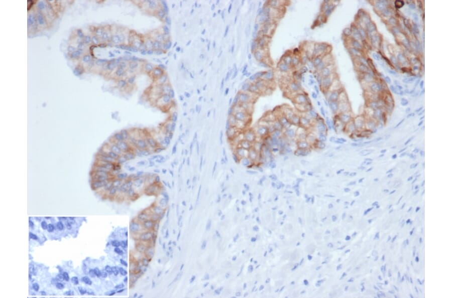 Immunohistochemistry - Anti-pan Cytokeratin Antibody [Cocktail PCK/4933R] - BSA and Azide free (A278693) - Antibodies.com