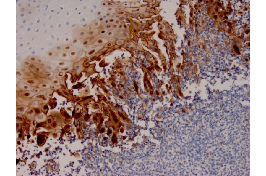 Immunohistochemistry - Anti-HSV1 Antibody [HSV1/4055R] - BSA and Azide free (A278696) - Antibodies.com