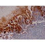 Immunohistochemistry - Anti-HSV1 Antibody [HSV1/4055R] - BSA and Azide free (A278696) - Antibodies.com