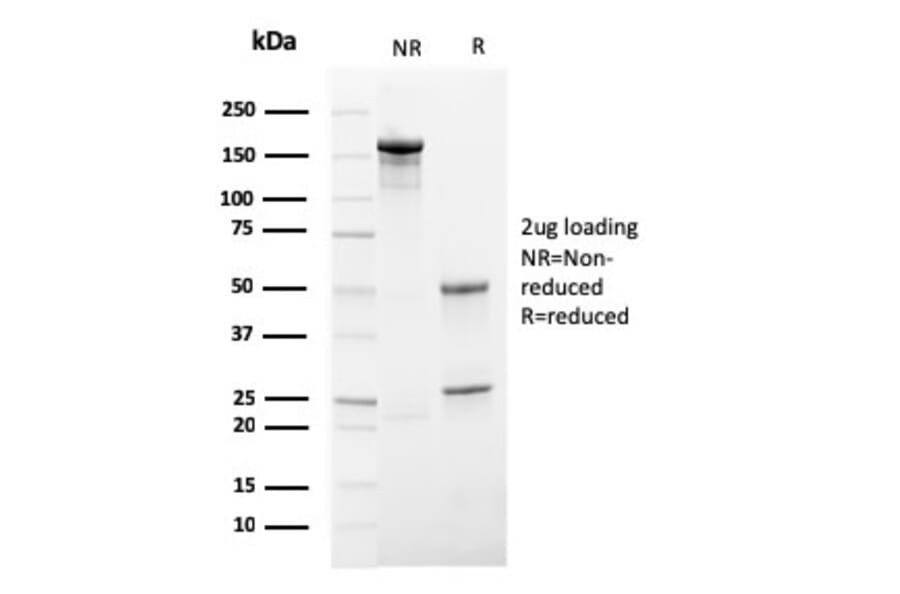 SDS-PAGE - Anti-HSV1 Antibody [HSV1/4055R] - BSA and Azide free (A278696) - Antibodies.com