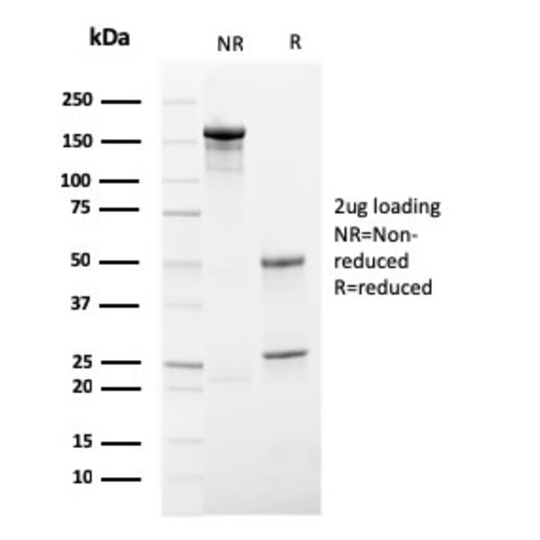 SDS-PAGE - Anti-HSV1 Antibody [HSV1/4055R] - BSA and Azide free (A278696) - Antibodies.com