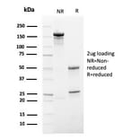SDS-PAGE - Anti-HSV1 Antibody [HSV1/4055R] - BSA and Azide free (A278696) - Antibodies.com