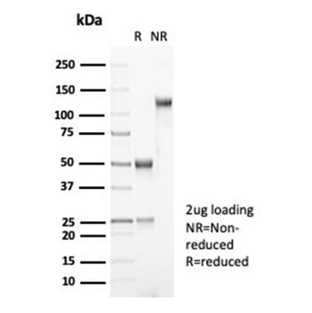 SDS-PAGE - Anti-MDM2 Antibody [MDM2/7061R] - BSA and Azide free (A278697) - Antibodies.com