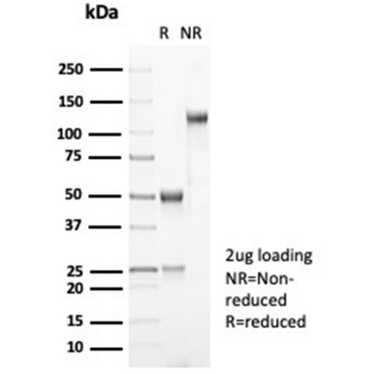 SDS-PAGE - Anti-MDM2 Antibody [MDM2/7061R] - BSA and Azide free (A278697) - Antibodies.com