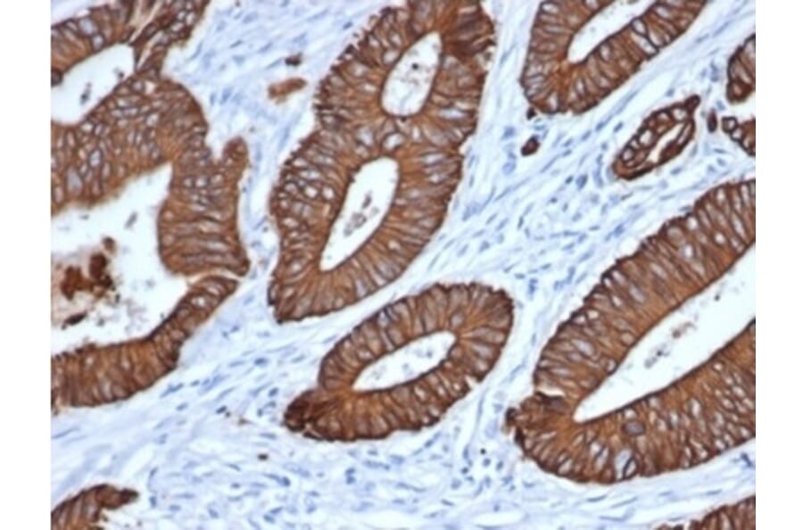 Immunohistochemistry - Anti-pan Cytokeratin Antibody [MonoPoly/7249R] - BSA and Azide free (A278698) - Antibodies.com