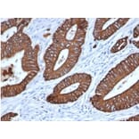 Immunohistochemistry - Anti-pan Cytokeratin Antibody [MonoPoly/7249R] - BSA and Azide free (A278698) - Antibodies.com