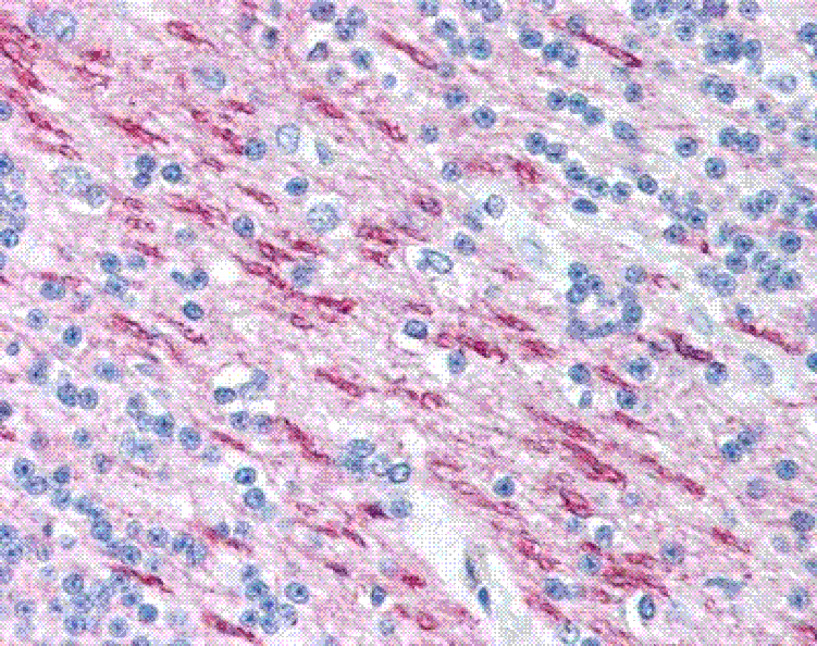 Immunohistochemistry - Anti-Myelin Basic Protein Antibody [22] (A278728) - Antibodies.com