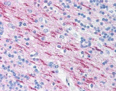 Immunohistochemistry - Anti-Myelin Basic Protein Antibody [22] (A278728) - Antibodies.com