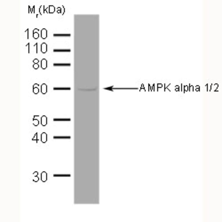 Western Blot - Anti-AMPK alpha 1 + AMPK alpha 2 Antibody [34.2] (A278734) - Antibodies.com
