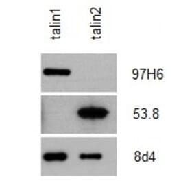Western Blot - Anti-Talin 2 Antibody [53.8] (A278749) - Antibodies.com