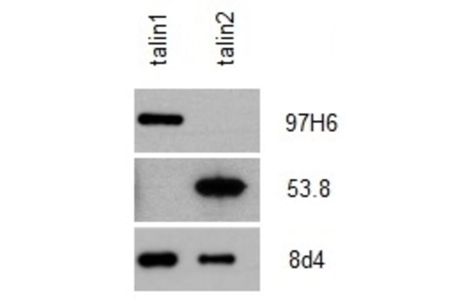 Western Blot - Anti-Talin 2 Antibody [53.8] (A278749) - Antibodies.com