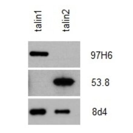 Western Blot - Anti-Talin 2 Antibody [53.8] (A278749) - Antibodies.com