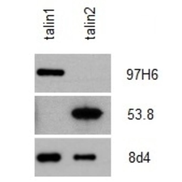 Western Blot - Anti-Talin 2 Antibody [53.8] (A278749) - Antibodies.com