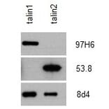 Western Blot - Anti-Talin 2 Antibody [53.8] (A278749) - Antibodies.com