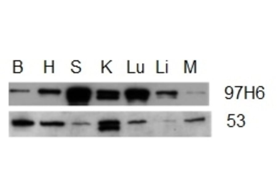 Western Blot - Anti-Talin 2 Antibody [53.8] (A278749) - Antibodies.com