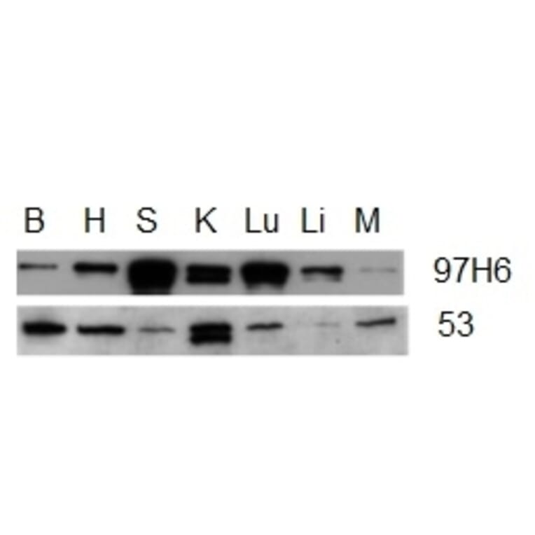 Western Blot - Anti-Talin 2 Antibody [53.8] (A278749) - Antibodies.com