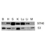 Western Blot - Anti-Talin 2 Antibody [53.8] (A278749) - Antibodies.com