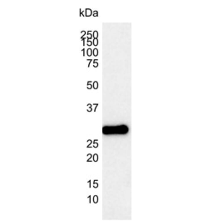 Western Blot - Anti-Bcl-2 Antibody [100] (A278770) - Antibodies.com