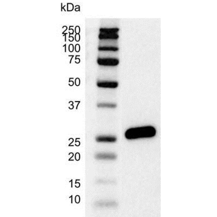 Western Blot - Anti-Bcl-2 Antibody [100] (A278770) - Antibodies.com