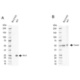 Western Blot - Anti-Bcl-2 Antibody [100] (A278770) - Antibodies.com